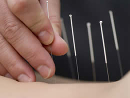 Acupuncture anxiété